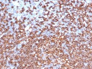 Immunohistochemical analysis of formalin-fixed, paraffin-embedded human lymph node tissue using Anti-CD20 Antibody [IGEL/6850R]