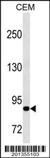 Anti-MMP9 Mouse Monoclonal Antibody