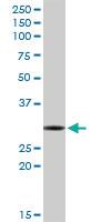 Anti-RNASEH2A Rabbit Polyclonal Antibody