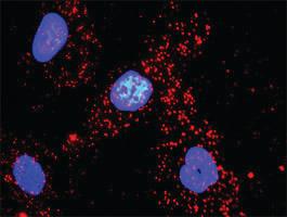 Anti-VASP + ACTG1 Antibody Pair