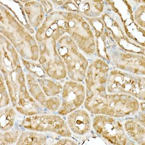 Anti-Hsp90 beta Rabbit Polyclonal Antibody