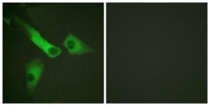 Immunofluorescence analysis of HepG2 cells using Anti-Caspase 9 (phospho Tyr153) Antibody. The right hand panel represents a negative control, where the antibody was pre-incubated with the immunising peptide