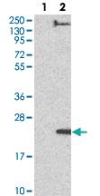 Anti-SZRD1 Rabbit Polyclonal Antibody