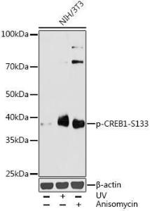 Western blot analysis of extracts of NIH/3T3 cells, using Anti-CREB (phospho Ser133) Antibody (A10929) at 1:1000 dilution