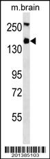 Anti-TSC1 Mouse Monoclonal Antibody