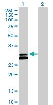 Anti-RNASEH2A Rabbit Polyclonal Antibody