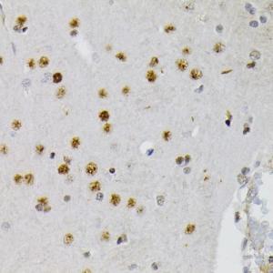 Immunohistochemistry analysis of paraffin-embedded rat brain using Anti-CREB (phospho Ser133) Antibody (A10929) at a dilution of 1:200 (40x lens)