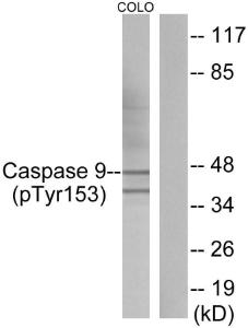 Western blot analysis of lysates from COLO205 cells using Anti-Caspase 9 (phospho Tyr153) Antibody. The right hand lane represents a negative control, where the antibody is blocked by the immunising peptide