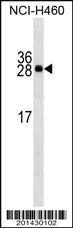 Anti-APCS Mouse Monoclonal Antibody