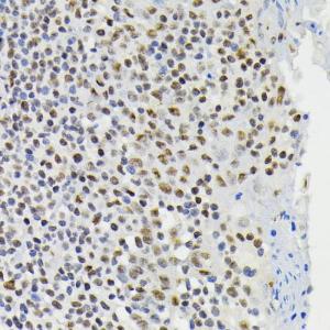 Immunohistochemistry analysis of paraffin-embedded human tonsil using Anti-CREB (phospho Ser133) Antibody (A10929) at a dilution of 1:200 (40x lens)