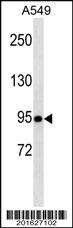 Anti-TLE1 Mouse Monoclonal Antibody