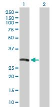 Anti-HLA-DRB5 Rabbit Polyclonal Antibody