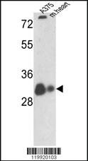 Anti-VDAC1 Rabbit Polyclonal Antibody