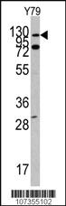 Anti-ABL1 Rabbit Polyclonal Antibody