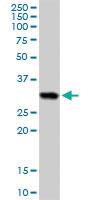 Anti-HLA-DRB5 Rabbit Polyclonal Antibody