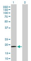 Anti-RPS19 Rabbit Polyclonal Antibody