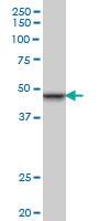 Anti-SMARCB1 Mouse Monoclonal Antibody [clone: 3E10]