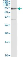 Anti-SUOX Polyclonal Antibody Pair