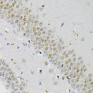 Immunohistochemistry analysis of paraffin-embedded mouse brain using Anti-CREB (phospho Ser133) Antibody (A10929) at a dilution of 1:200 (40x lens)