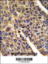 Anti-VDAC1 Rabbit Polyclonal Antibody