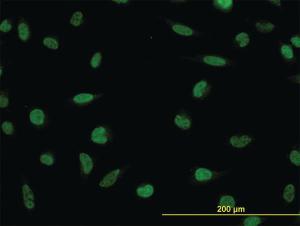 Anti-LDB2 Mouse Monoclonal Antibody [clone: 1C2]