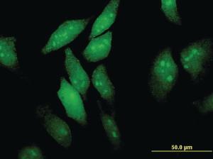 Anti-EIF4ENIF1 Mouse Monoclonal Antibody [clone: 2C4]