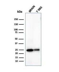 Antibody anti-PGP95 UCHL14558 100 µg