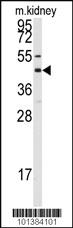 Anti-GJA8 Rabbit Polyclonal Antibody