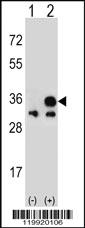 Anti-VDAC1 Rabbit Polyclonal Antibody