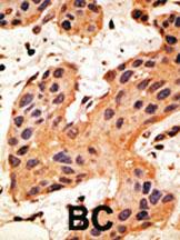 Anti-GJA8 Rabbit Polyclonal Antibody