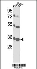 Anti-VDAC1 Rabbit Polyclonal Antibody