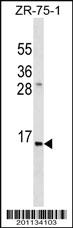 Anti-INS Mouse Monoclonal Antibody