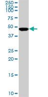 Anti-SMARCB1 Mouse Monoclonal Antibody [clone: 3E10]