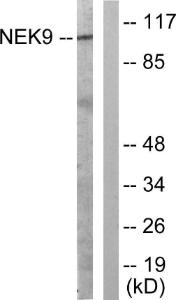 Western blot analysis of lysates from A549 cells using Anti-NEK9 Antibody The right hand lane represents a negative control, where the antibody is blocked by the immunising peptide