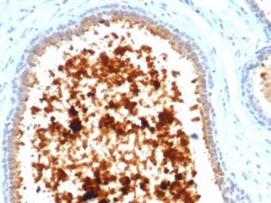 Immunohistochemical analysis of formalin-fixed, paraffin-embedded human lactating breast using Anti-Mammaglobin A Antibody [MGB/4811R]