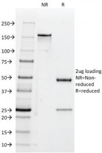 SDS-PAGE analysis of Anti-CD47 Antibody [B6H12.2] under non-reduced and reduced conditions; showing intact IgG and intact heavy and light chains, respectively. SDS-PAGE analysis confirms the integrity and purity of the antibody