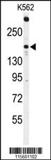 Anti-TNK2 Rabbit Polyclonal Antibody