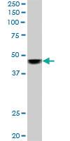 Anti-SMARCB1 Mouse Monoclonal Antibody [clone: 3E10]