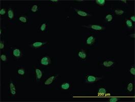 Anti-LDB2 Mouse Monoclonal Antibody [clone: 1C2]