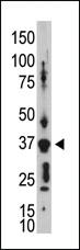 Anti-GJD2 Rabbit Polyclonal Antibody