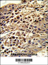 Anti-VDAC1 Rabbit Polyclonal Antibody