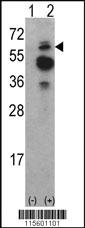 Anti-TNK2 Rabbit Polyclonal Antibody