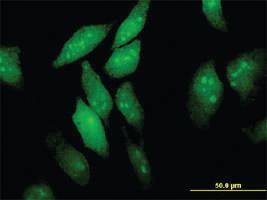 Anti-EIF4ENIF1 Mouse Monoclonal Antibody [clone: 2C4]