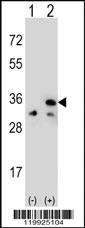 Anti-VDAC1 Rabbit Polyclonal Antibody