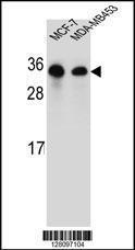 Anti-SAR1B Rabbit Polyclonal Antibody