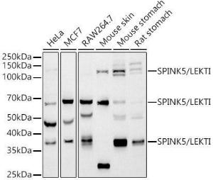 Western blot analysis of extracts of various cell lines, using Anti-SPINK5 / LEKTI Antibody [ARC2888] (A305882) at 1:1,000 dilution. The secondary antibody was Goat Anti-Rabbit IgG H&L Antibody (HRP) at 1:10,000 dilution.