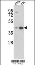 Anti-AZGP1 Rabbit Polyclonal Antibody