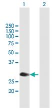 Anti-MYCL Mouse Polyclonal Antibody