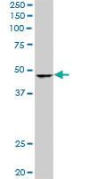 Anti-SMARCB1 Mouse Monoclonal Antibody [clone: 3E10]