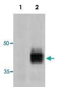 Anti-FASLG Rat Monoclonal Antibody [clone: H11]